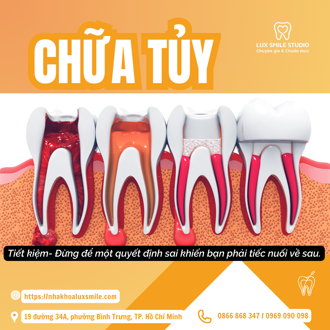 Chữa tủy – Đừng để vì tiết kiệm mà ra một quyết định sai, khiến bạn phải tiếc nuối về sau.
