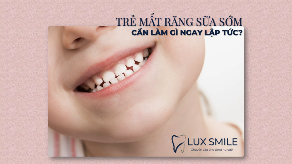 Mất răng sữa sớm ở trẻ