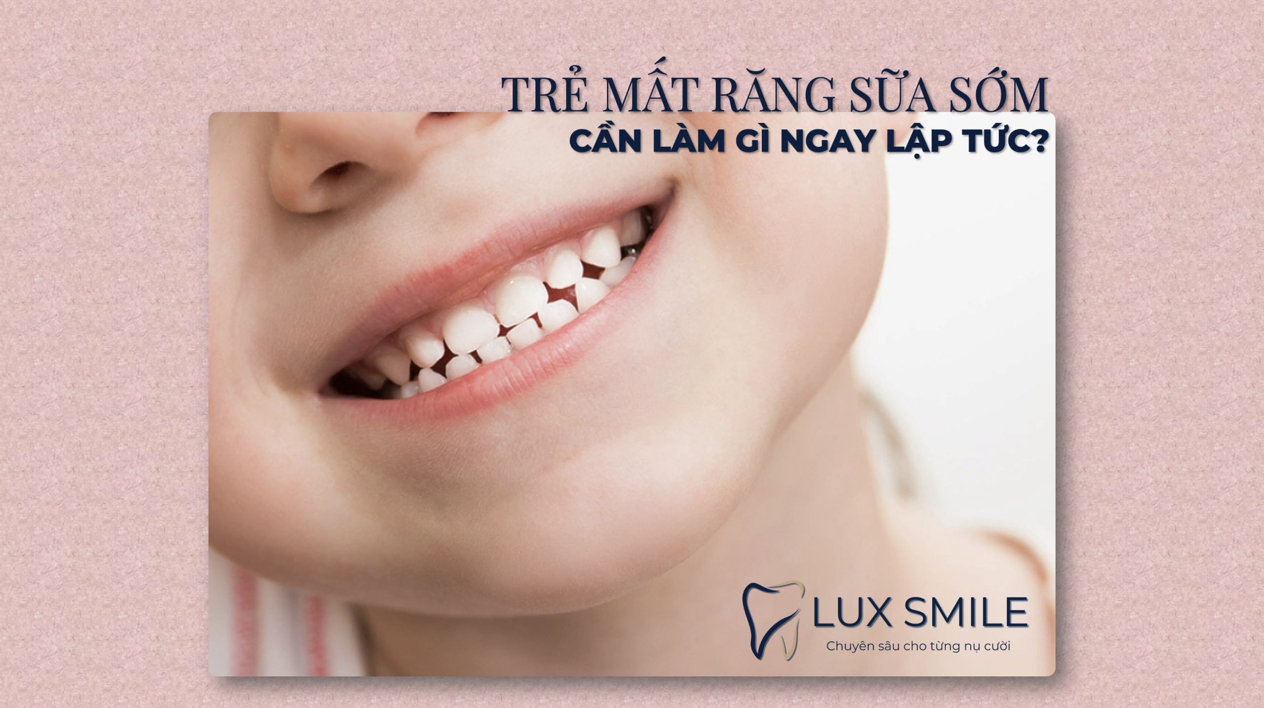 Mất răng sữa sớm ở trẻ